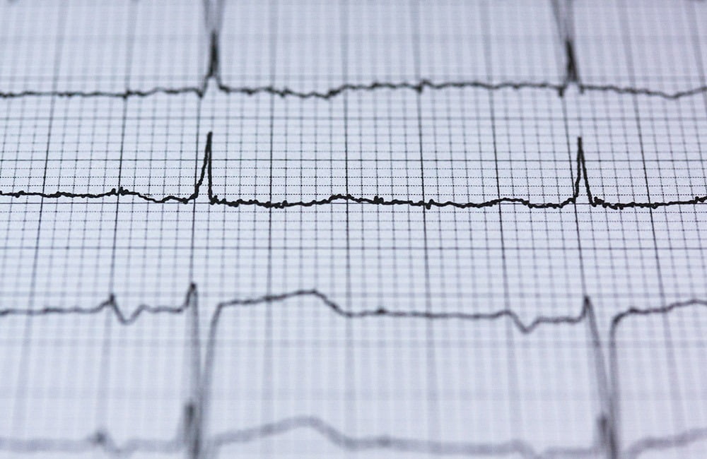 Heartbeat chart