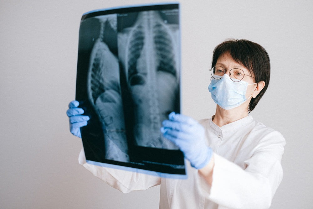 Doctor holding up lung scan