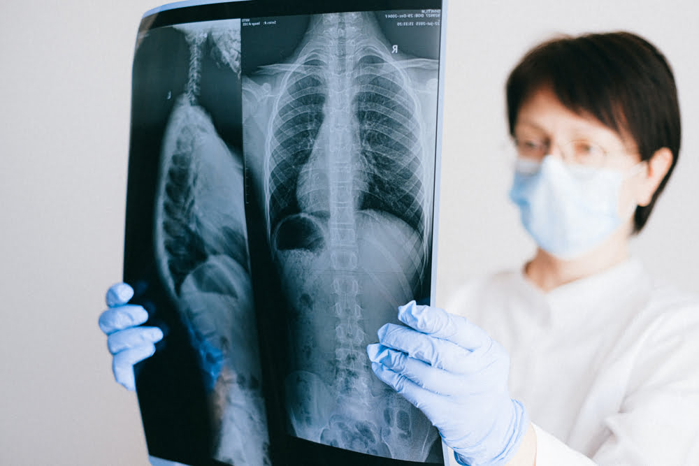 Doctor inspecting an X-ray of someone's lungs