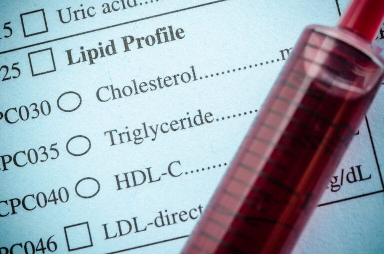 A cholesterol blood test result chart.