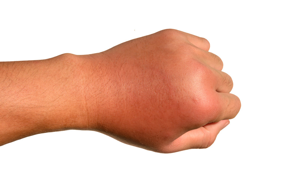 Skin disease and skin surveillance of the hand